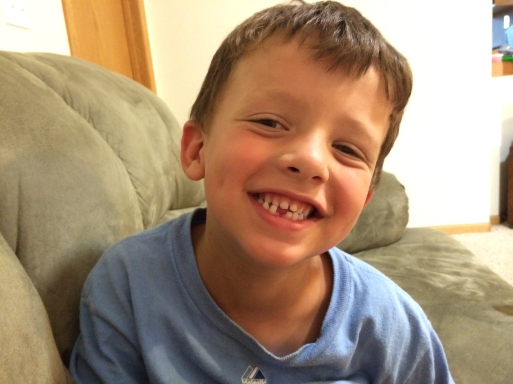 Leo lost his first tooth!